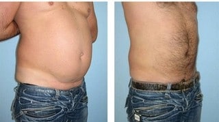 Отзывы и фото похудевших до и после, всего за 14 дней!